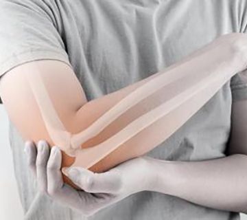 Nerja se suma al apoyo del Día Mundial de la Osteogénesis Imperfecta